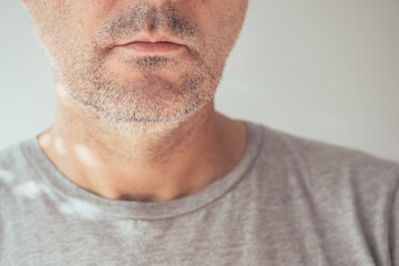 Male chin and jawline, closeup of unshaven man's face - obrazy, fototapety, plakaty