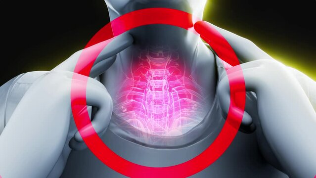 Abstract animation of a man and a sore throat