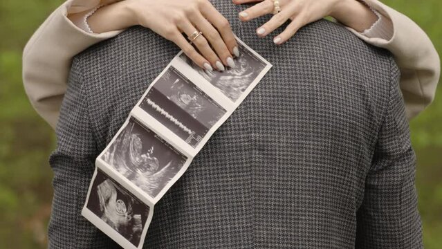 A woman holding an ultrasound scan behind a man's back, both wearing rings, depicting a couple expecting a child, perfect for stock video content related to pregnancy, family, and love.