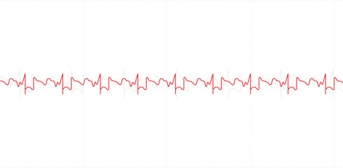 Naklejka premium Electrocardiography heartbeat line monitor. Ecg