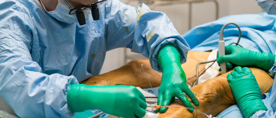 Process of varicose vein surgery in hospital, vein sealing, venous vascular surgery, phlebectomy...