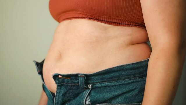 Closeup of fat folds on big belly of overweight woman. Concept of excessive weight, obese female, dieting and overweight problems. High quality FullHD footage