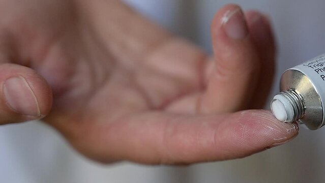 Close-up footage on tube of antibiotic cream: a small dose of ointment is squeezed onto the finger for application.