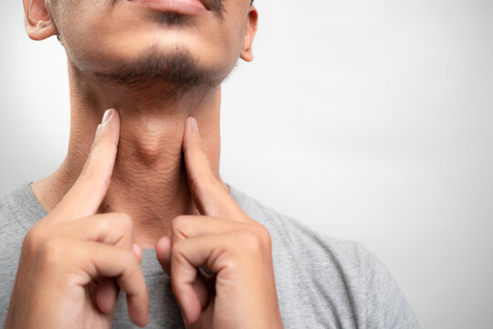 Inflammation of the thyroid gland, sore throat and cough, man with neck pain on white background, health problems concept. Close up. Isolated on white background