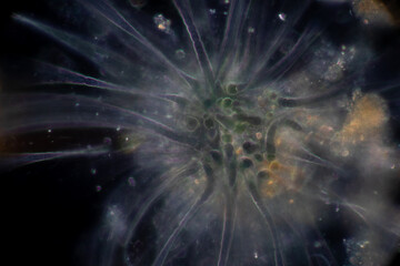 Backgrounds of Bacteria and Mold under the microscope in Lab.