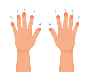 Frostbite stages. Frozen hands. Medical frostbite. Skin burn symptom. Health care medical concept. Vector