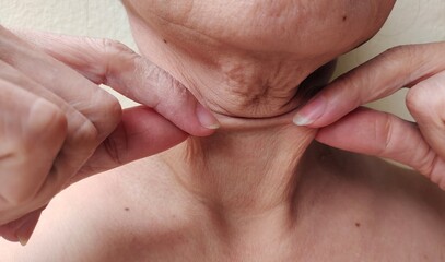 Portrait showing the fingers holding the flabbiness and wrinkle under the neck, wattle and flabby skin under the chin of the woman, health care and beauty concept.