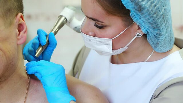 A dermatologist removes skin tumors with a laser, close up view of process of removing skin diseases