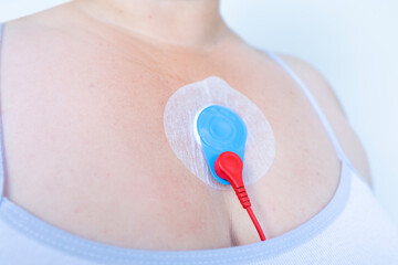 electronic sensor on chest for Holter monitoring, track pacemaker dysfunction, daily monitoring of...