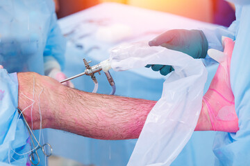 Surgeon use laparoscopic instrument for leg patient minimally invasive surgery. Suturing tendons...