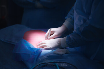 Closeup process Surgery doctor sews up punctures in abdominal cavity with thread after using laparoscopic instrument