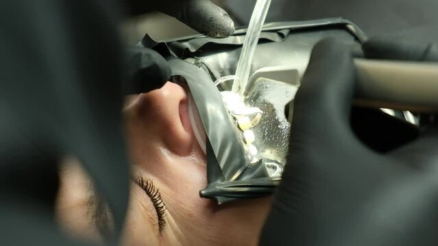 Washing ceramic veneers with water. Close-up.