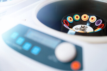 Photo of a testing tubes placed in a centrifuge ready for an analysis. Blood centrifuge machine.