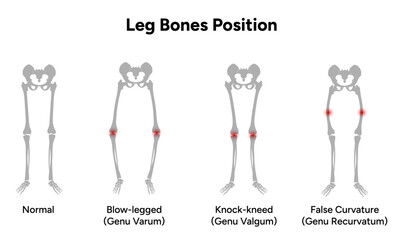 Leg bones positions 