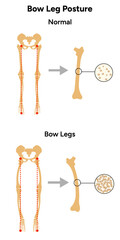 Leg bones position