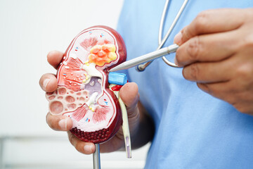 Chronic kidney disease, doctor with model for treatment urinary system, urology, Estimated...