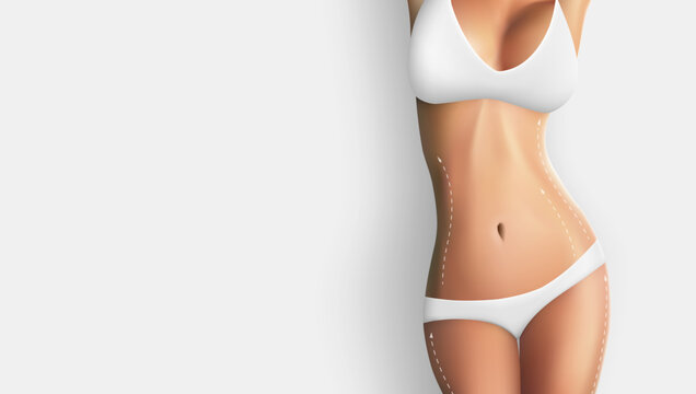3D Cosmetic Surgery Or Skin Liposuction Template