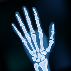 Naklejka premium Realistic 2D X-ray Hand Dark Medical Image