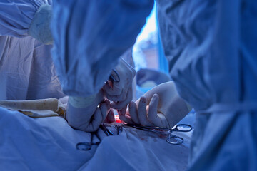 surgical operation close up, selective focus