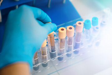 Rack with tubes blood samples from patients for analysis in the hematology lab .