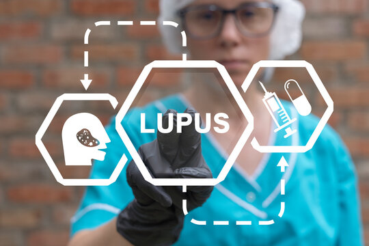 Doctor using virtual touch screen presses word: LUPUS. Lupus disease health care concept. Systemic lupus erythematosus. Symptoms, treatment, therapy.
