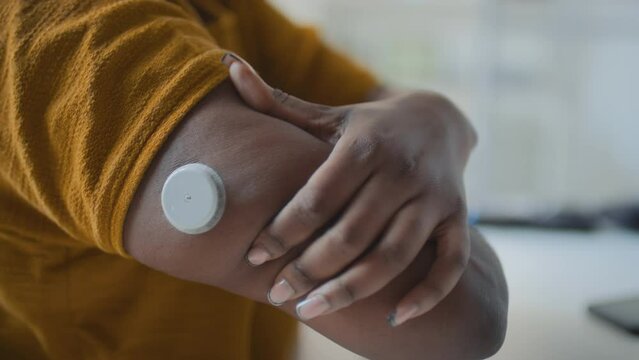 Close-up shot of hands of unrecognizable medical practitioner implanting continuous glucose monitoring system on upper arm of black female patient with diabetes during visit to clinic