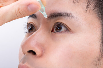 目薬をさす男性　man applying eye drops