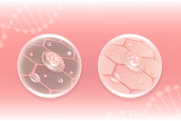 Hyaluronic acid before and after hair and skin solutions ad. pink collagen serum drop into skin cells with cosmetic advertising background ready to use, 
