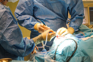 Doctors are surgery to patient at operating room.