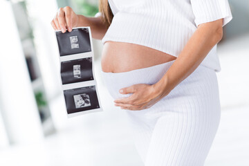 Cropped photo of lovely charming mama mom hands touching tummy showing x-ray scan result picture pregnancy motherhood