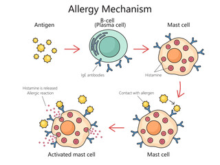 Mechanism of allergy action diagram hand drawn schematic vector illustration. Medical science educational illustration