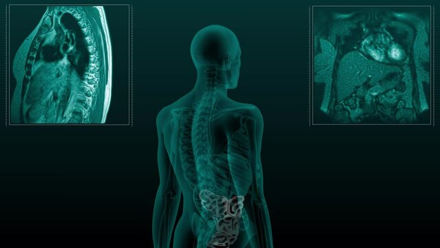 Magnetic resonance tomography  scan of the human digestive system. Anatomically accurate 3d render animation of the small intestine
