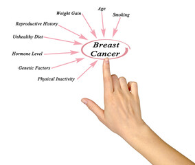 factors Influencing Risk of Breast Cancer