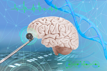 Electronic chip, bug in scientist's hand, Successful implantation of wireless chip into human brain, Cybernetics and Human Enhancement, Future of Brain-Computer Interfaces