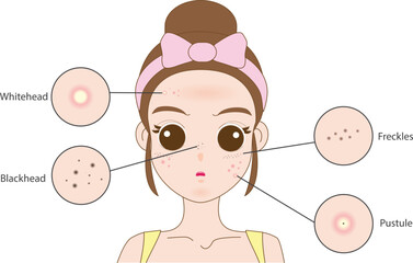 Troubled woman and set of most common female facial skin problems needs to care about: acne ,Freckle and dull skin.