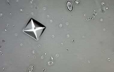 Calcium oxalate crystal from urine sediment.