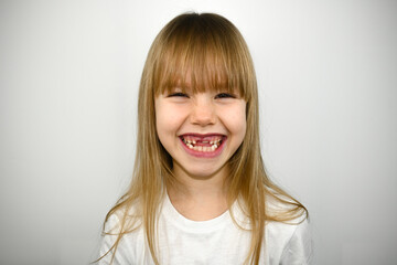 Little adorable girl with blonde hair smiling with her mouth wide open. Baby teeth, some have fallen out. White background