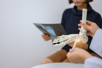 An orthopedic surgeon or therapist shows a patient a model of ankle and foot bones and explains...