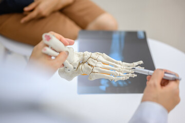 Close-up photo of an orthopedic doctor holding a model of ankle and foot bones explaining to a...