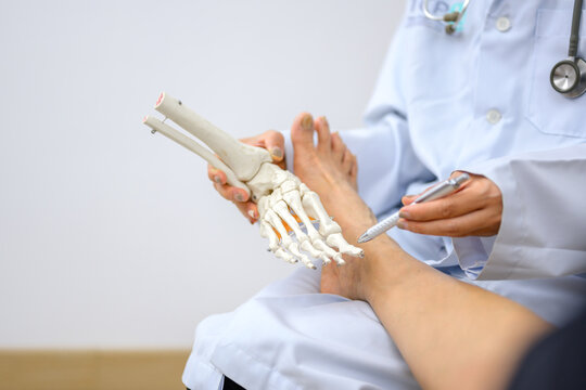 Close-up picture of an orthopedic doctor wearing medical gloves An orthopedic doctor examines a patient's feet and toes to analyze the cause of foot degeneration in his office at the hospital.
