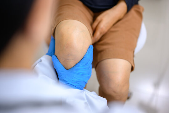 Doctor examining the knee of a woman who has a knee injury Knee joint treatment by an orthopedic surgeon Treat knee joint pain caused by running or improper exercise.