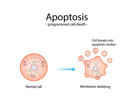 Apoptosis. Programmed cell death. Aging process in cells. Stages of apoptosis, normal cell, shrinkage, membrane blebbing, cell breaks into apoptotic bodies and phagocytosis. vector illustration.