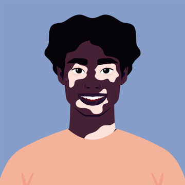 African young man with vitiligo depigmentation. Rare appearance. Portrait or an avatar. Vector illustration