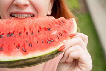 Close-up portrait of red-haired young woman with braces eating watermelon outdoors