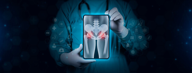 The doctor holds a tablet and examines a pelvic x-ray in digital format. Pain in the cartilage joints, femoral head. Pelvis, degenerative hip disease. Arthritis and osteoarthritis - obrazy, fototapety, plakaty