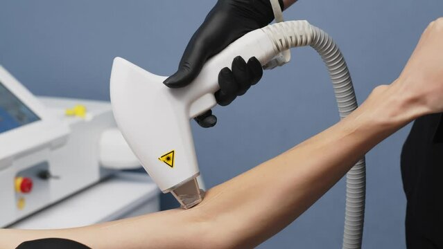 Flash of diode laser hair removal, cosmetologist removes hair on beautiful female hands, hair removal for smooth skin, laser procedure in a beauty clinic, body care hair removal