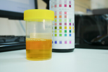 Urine analysis in laboratory.