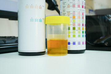 Urine analysis in laboratory.