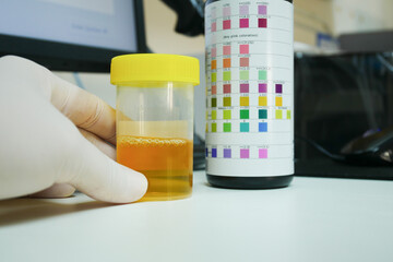 Urine analysis in laboratory.