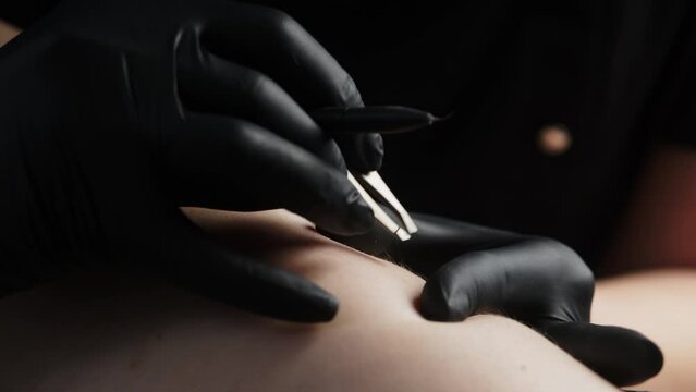 The process of removing unwanted hair using a device for electrolysis in a cosmetology office on a dark background. Close-up macro photography.